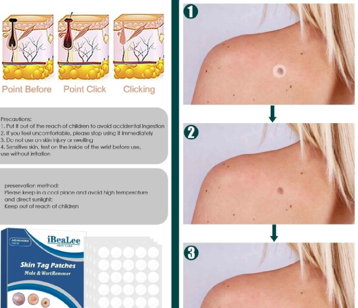 картинка Патчи стики от акне от магазина Одежда+