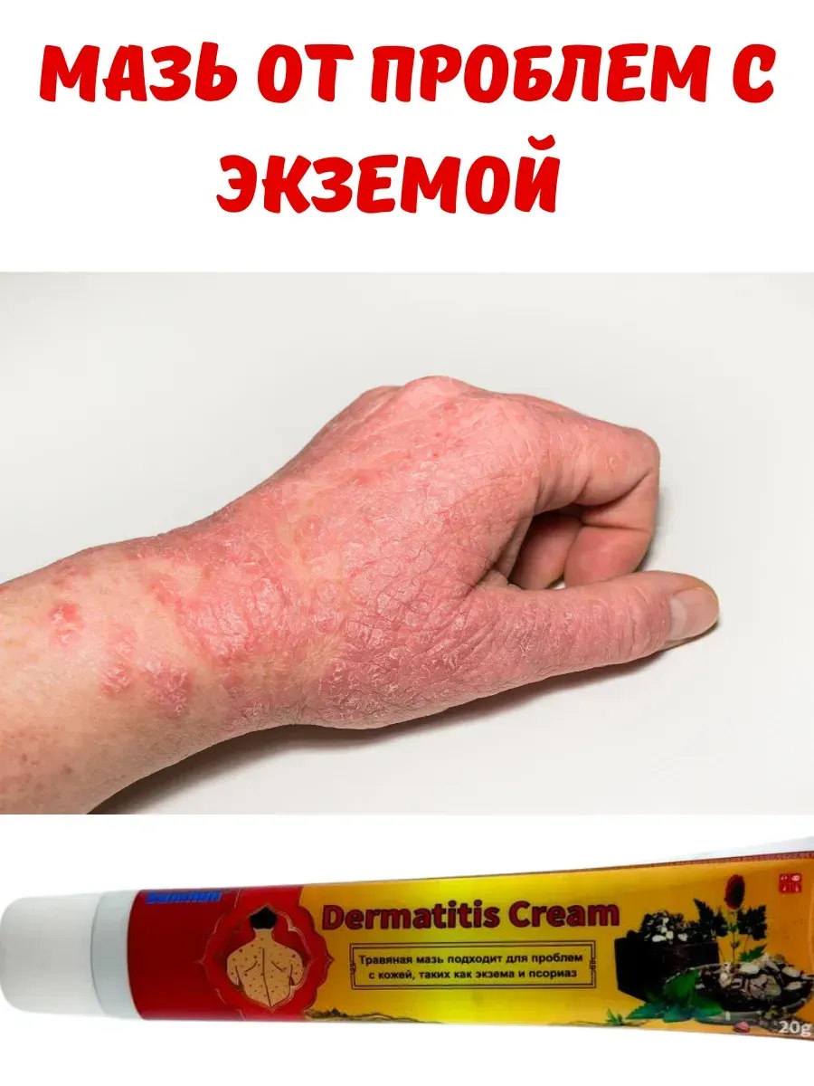 картинка Мазь от псориаза, экземы и дерматита 20г. ЧудоМазь от магазина Одежда+