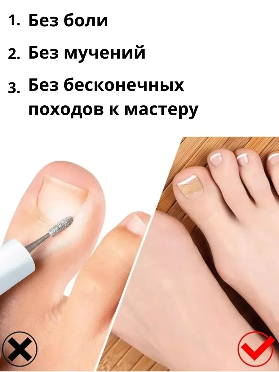 картинка средство от вросших ногтей пластырь от вросших ногтей от магазина Одежда+