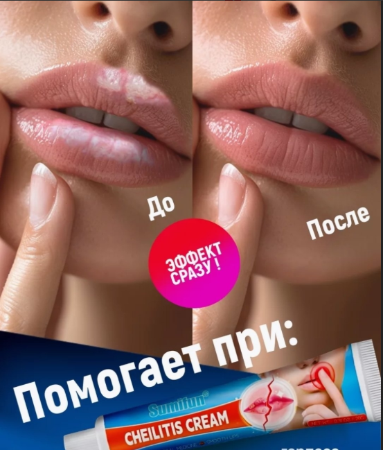 картинка Бальзам для губ с ацикловиром от магазина Одежда+