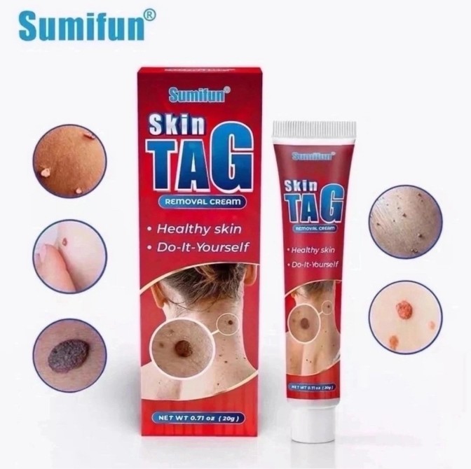 картинка Мазь от папиллом и бородавок от магазина Одежда+