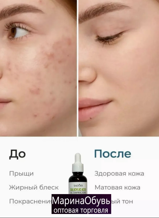 картинка Сыворотка для лица салициловая от магазина Одежда+