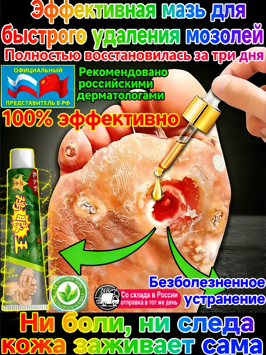 картинка Мазь от мозолей и натоптышей на ногах от магазина Одежда+