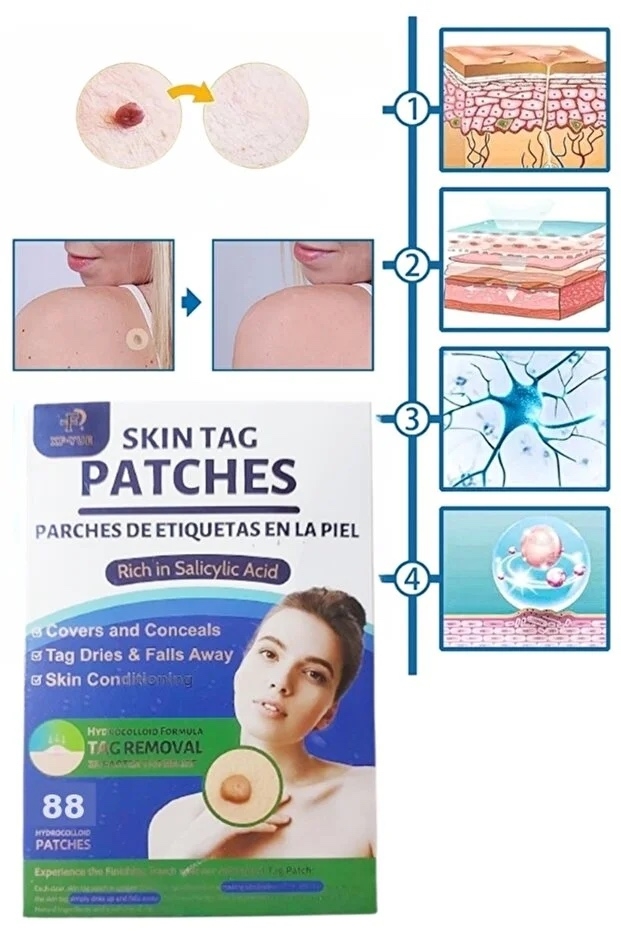 картинка Патчи от папиллом, бородавок, угревой сыпи от магазина Одежда+