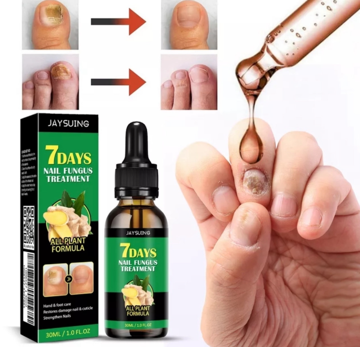 картинка Сыворотка для ногтей против грибка от магазина Одежда+