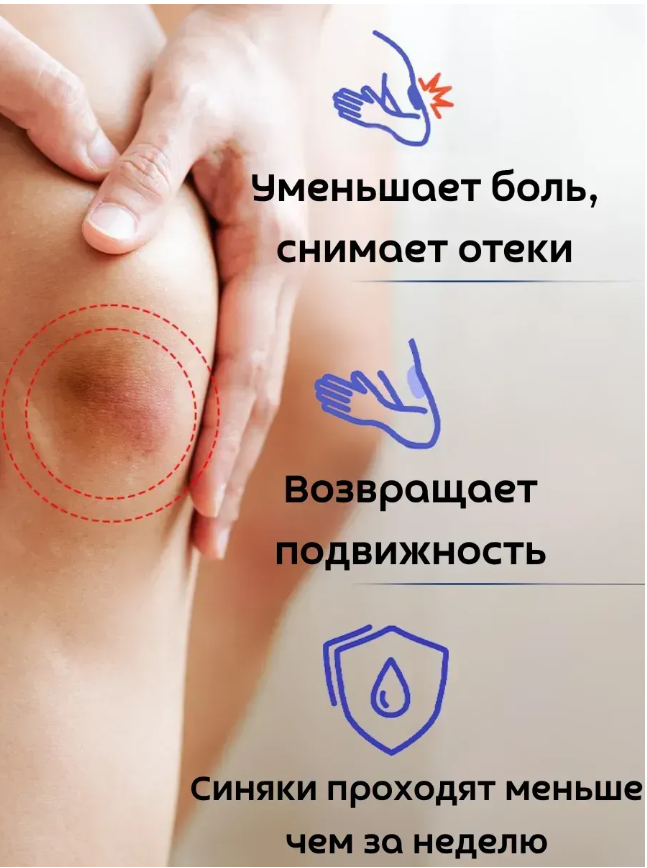 картинка Мазь от ушибов и гематом от магазина Одежда+