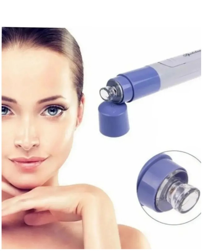 картинка Вакуумный очиститель пор - Spot Cleaner от магазина Одежда+