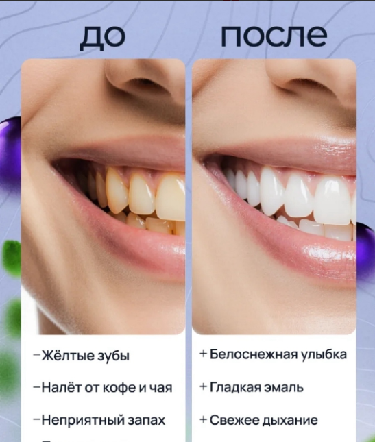 картинка Отбеливающая зубная  паста от магазина Одежда+