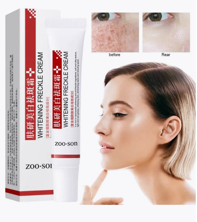 картинка Отбеливающий крем против веснушек 80 мл от магазина Одежда+