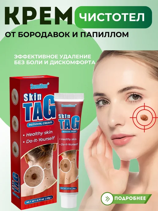 картинка Крем Skin Tag Removal Cream — эффективное средство для удаления бородавок и папиллом. от магазина Одежда+