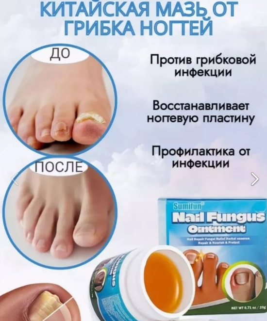 картинка Мазь против грибковой инфекции ногтей. от магазина Одежда+