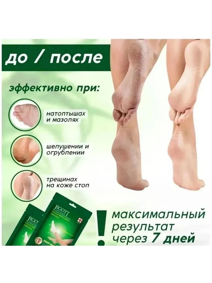 картинка Отшелушивающие носочки для пилинга от магазина Одежда+