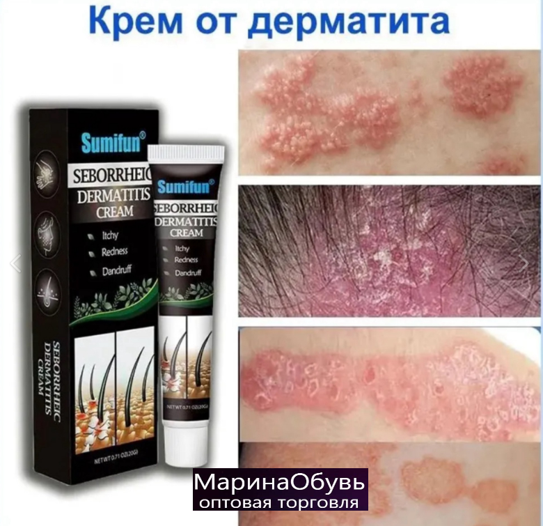 картинка Крем от дерматита от магазина Одежда+