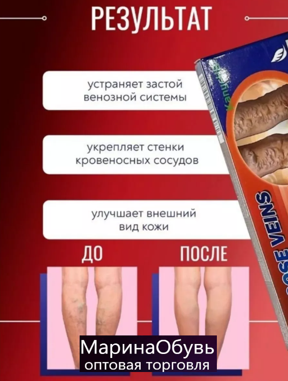 картинка Крем от варикоза от магазина Одежда+