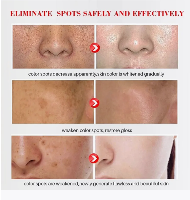 картинка Отбеливающий крем против веснушек 80 мл от магазина Одежда+