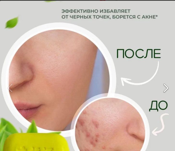 картинка Медицинское серное мыло от магазина Одежда+