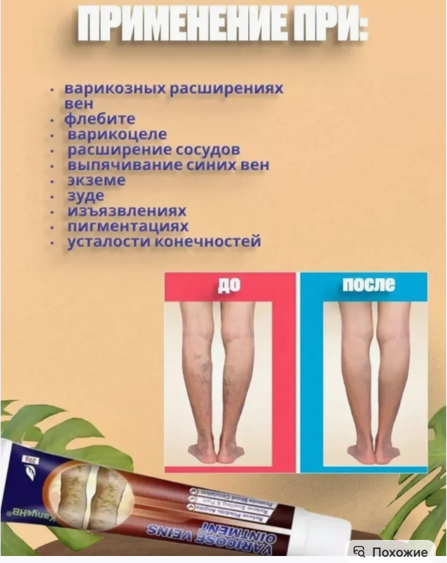 картинка набор 2в 1 Крем мазь  от варикоза 0,02 г от магазина Одежда+