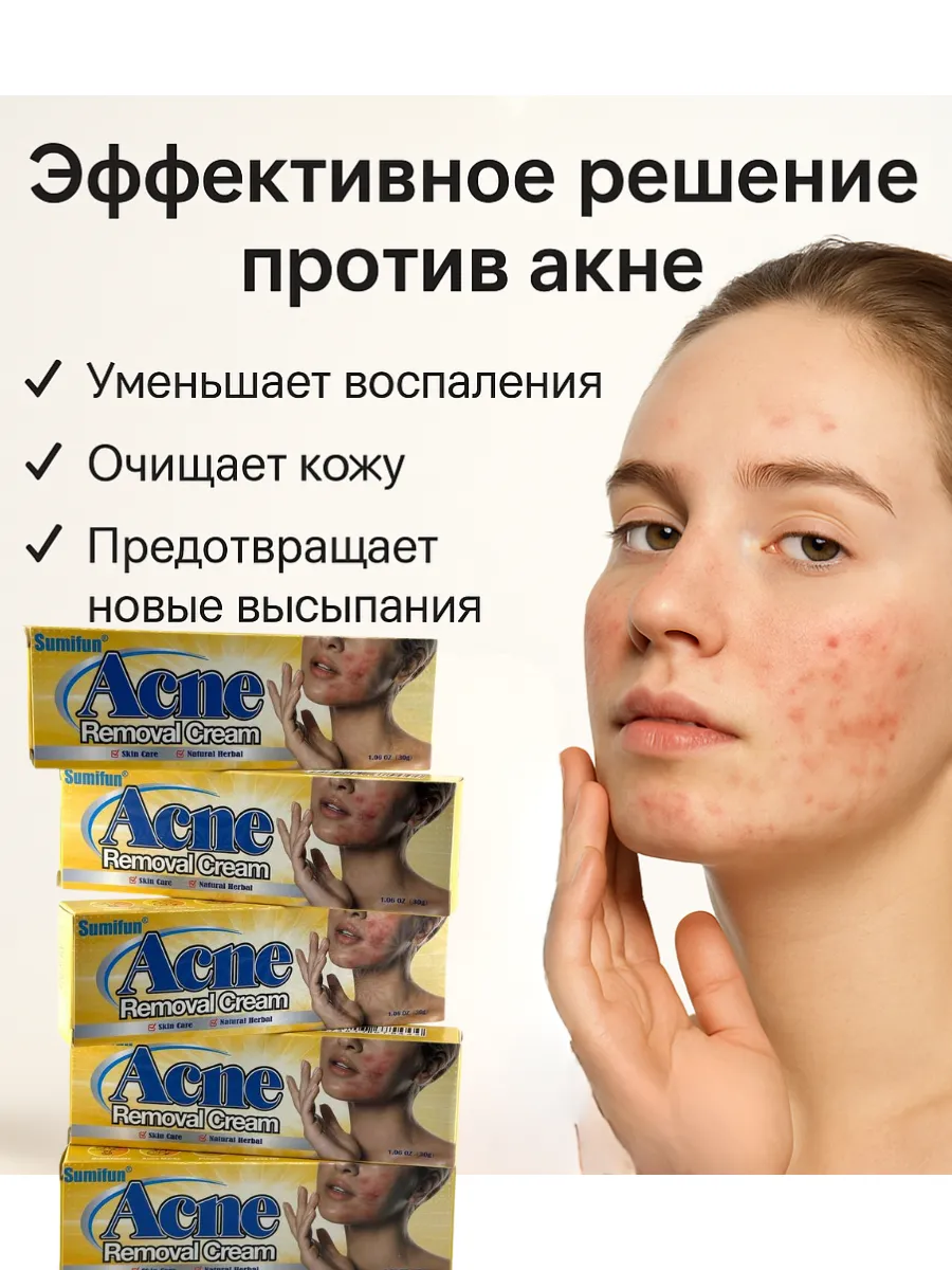 картинка Крем от прыщей и акне , для проблемной кожи от магазина Одежда+