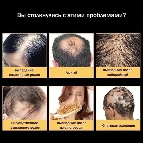 картинка Сыворотка для роста волос 100мл от магазина Одежда+