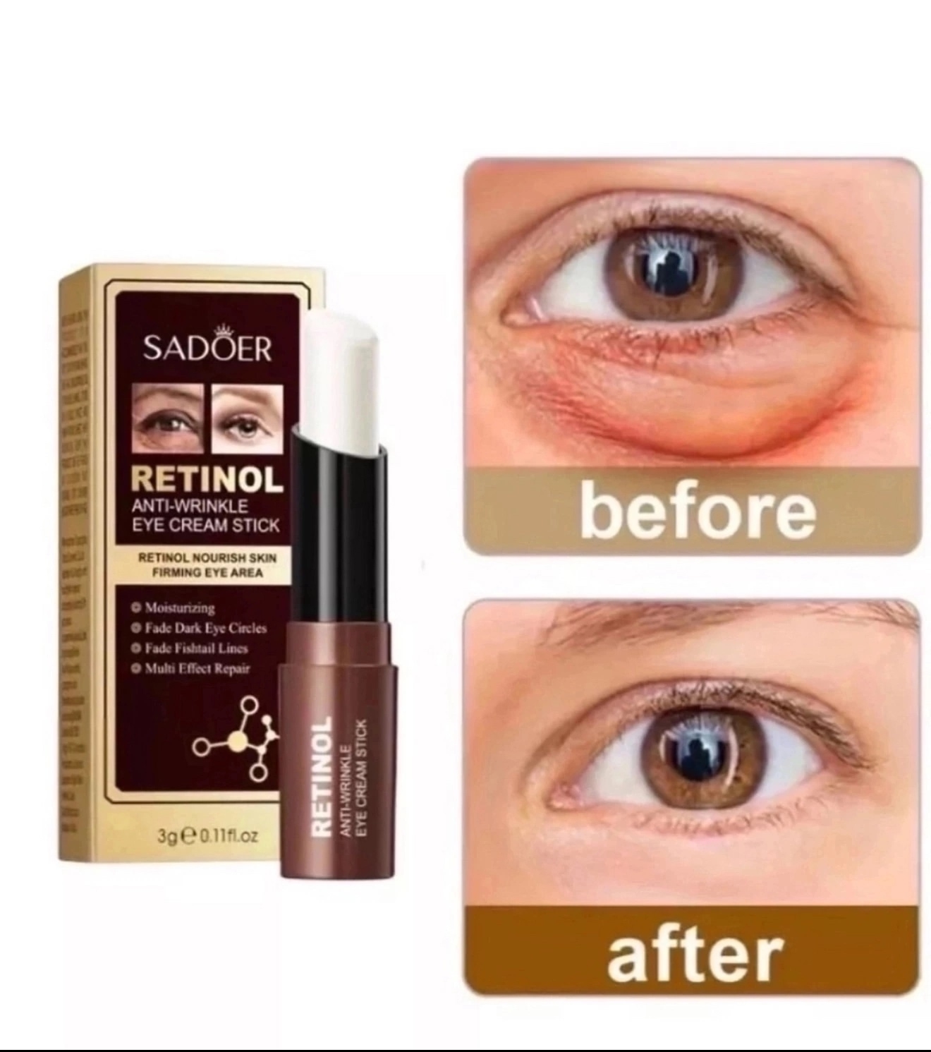 картинка Крем - стик с ретинолом для области вокруг глаз Sadoer. от магазина Одежда+