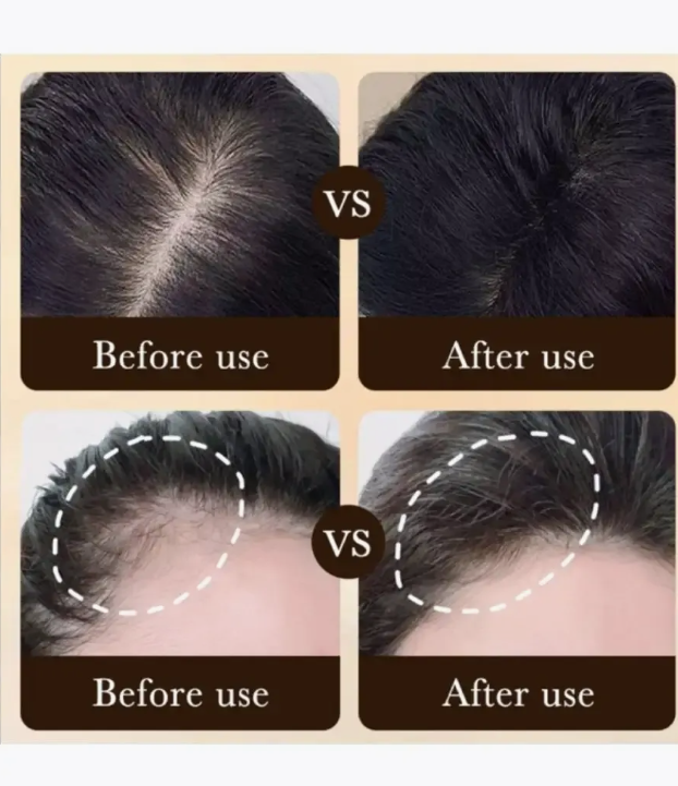 картинка Сыворотка против выпадения волос 20мл от магазина Одежда+