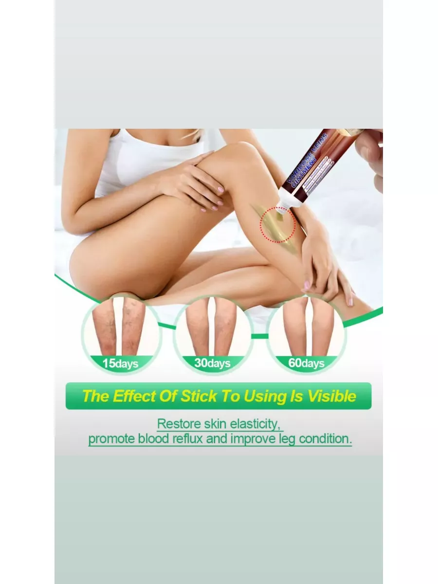 картинка Крем мазь от варикоза ног от магазина Одежда+