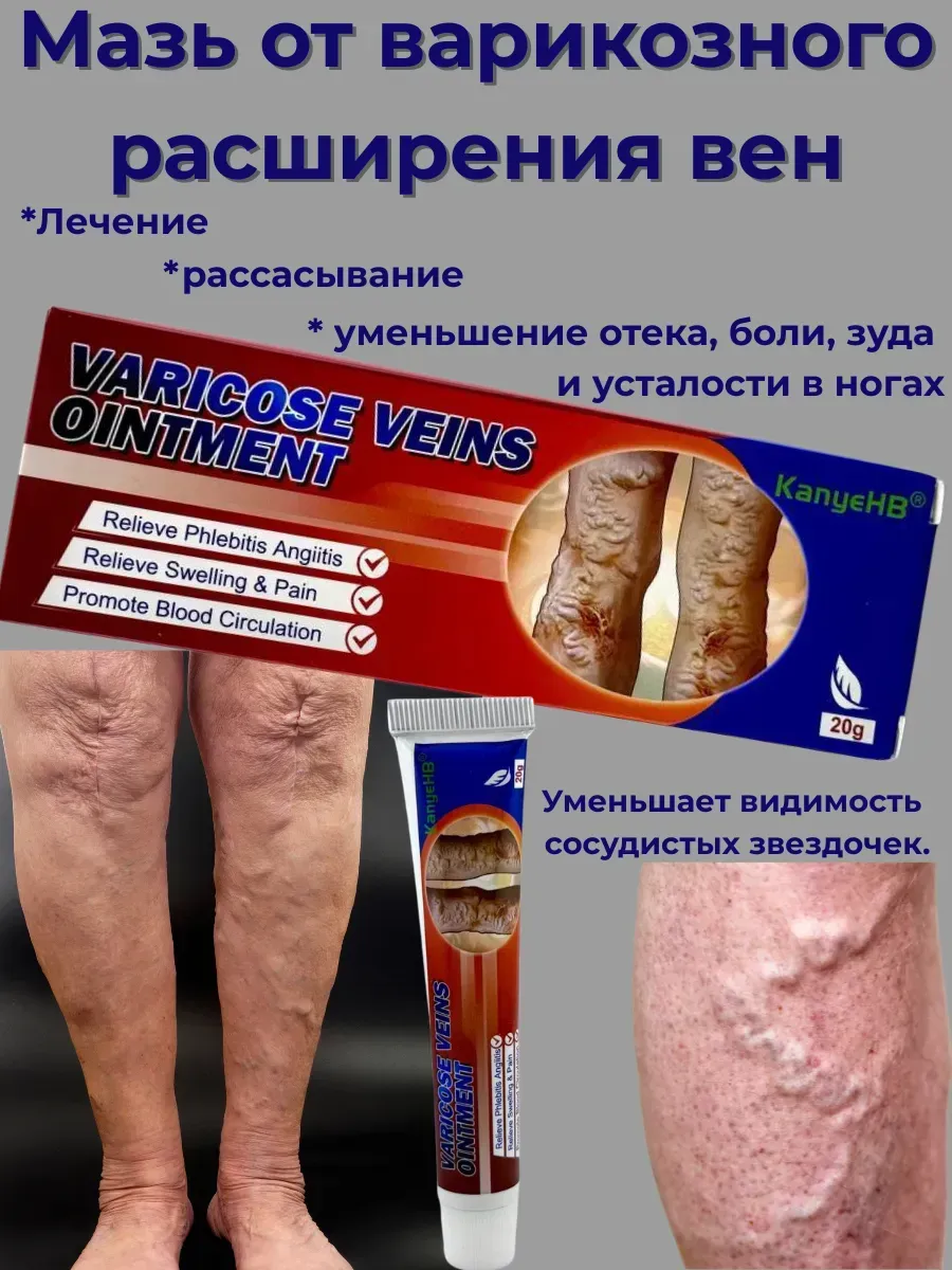 картинка Мазь от варикоза на ногах китай от магазина Одежда+