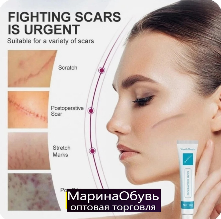 картинка Гель травяной от шрамов и рубцов от магазина Одежда+