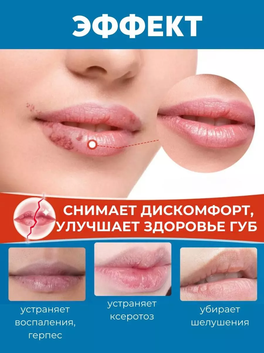 картинка Бальзам для губ лечебный от магазина Одежда+