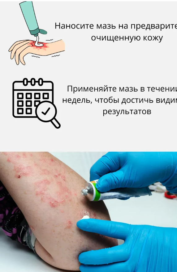 картинка Китайская чудо мазь от псориаза и дерматита от магазина Одежда+