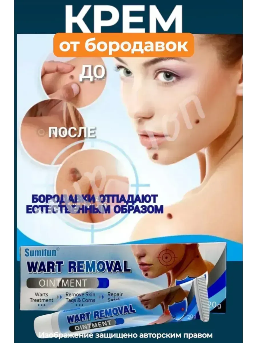 картинка Мазь для удаления бородавок и мозолей от магазина Одежда+