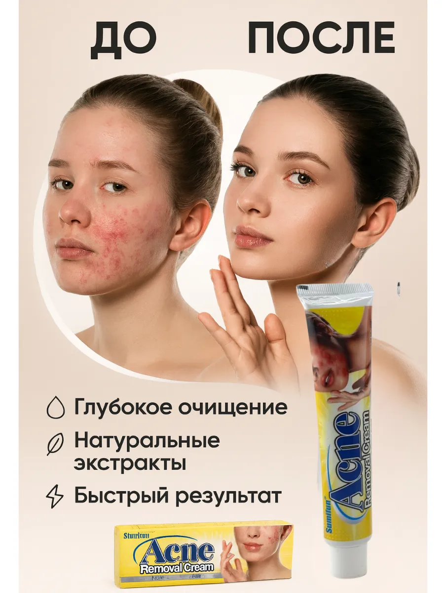 картинка Крем от прыщей и акне , для проблемной кожи от магазина Одежда+