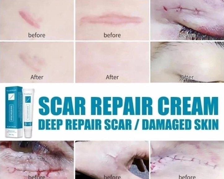 картинка Гель травяной от шрамов и рубцов от магазина Одежда+