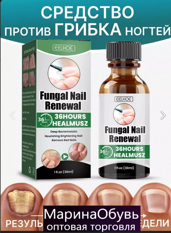 картинка Средство для лечения грибка ногтей от магазина Одежда+